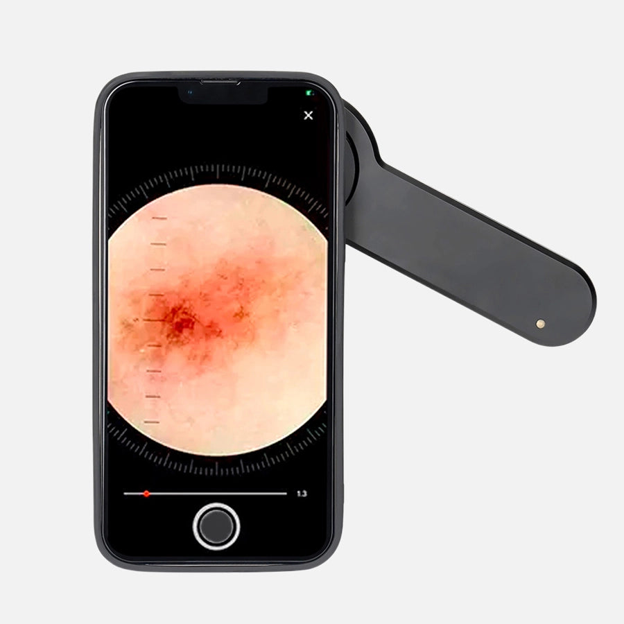 stratum | DE-3100PRO Dermatoscope