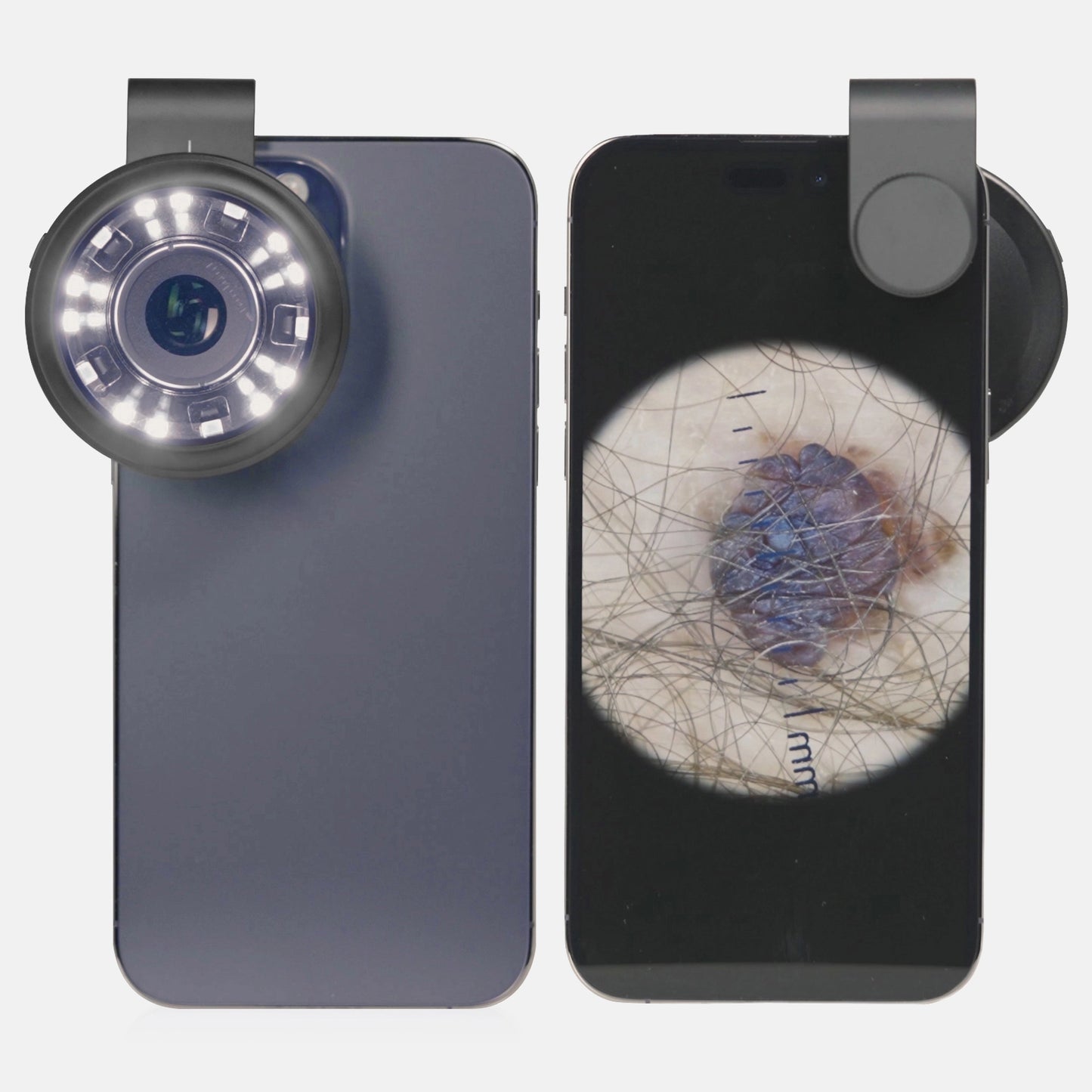 stratum | DE-400 Dermatoscope