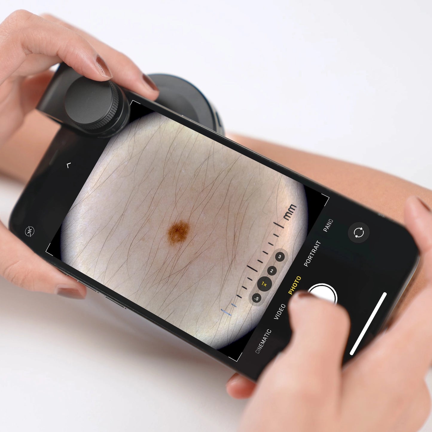 stratum | DE-400 Dermatoscope