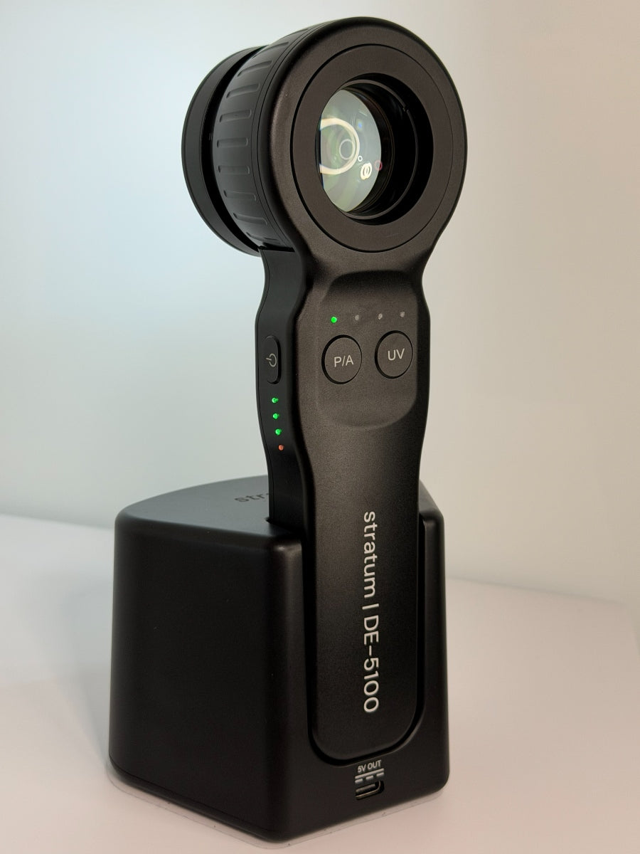 stratum | DE-5100 Dermatoscope